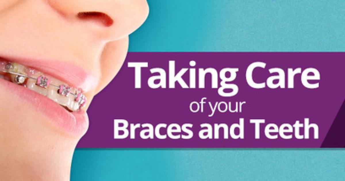 Orthodontic appliances ? tricks and tips to keeping a beautiful smile
