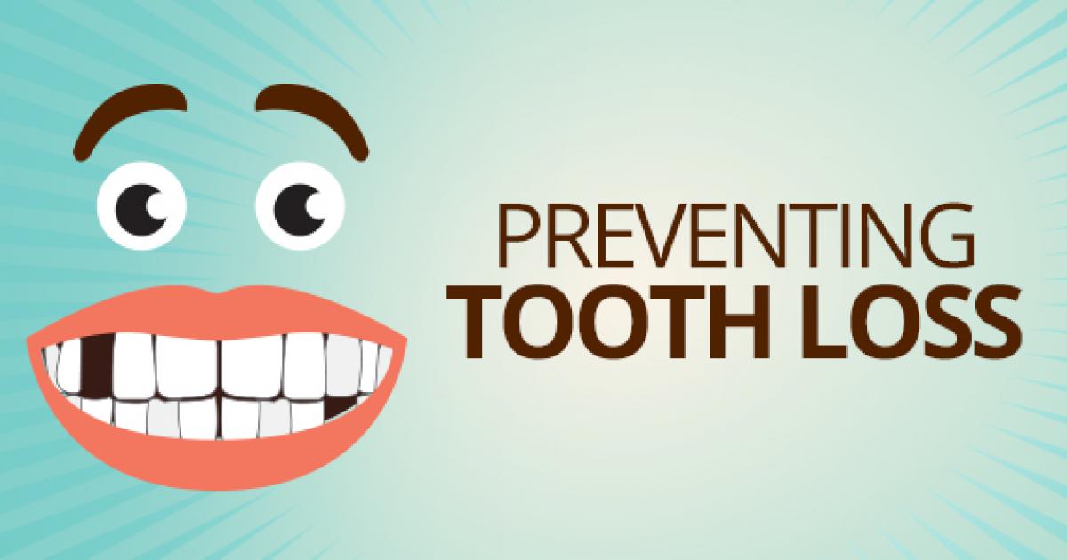 Preventing tooth loss ? SDG Gives you Tips to Keep Every Tooth in its Place