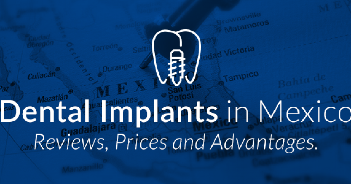 Dental Implants in Mexico Reviews, Prices, and Advantages