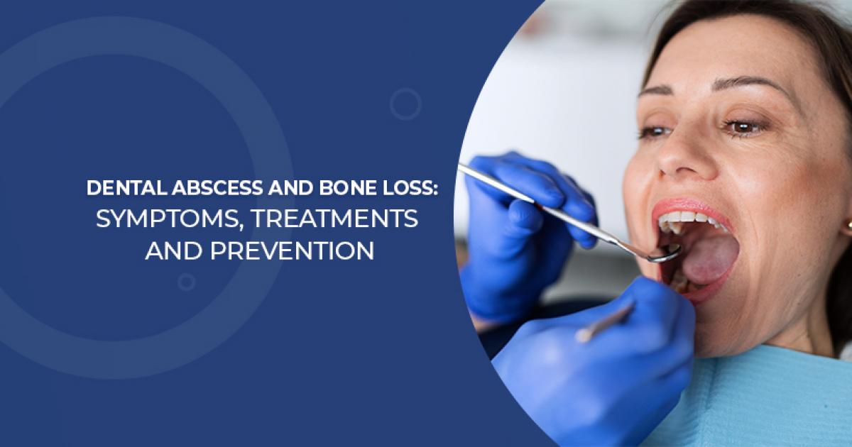 Dental Abscess and Bone Loss Symptoms, Treatments, and Prevention