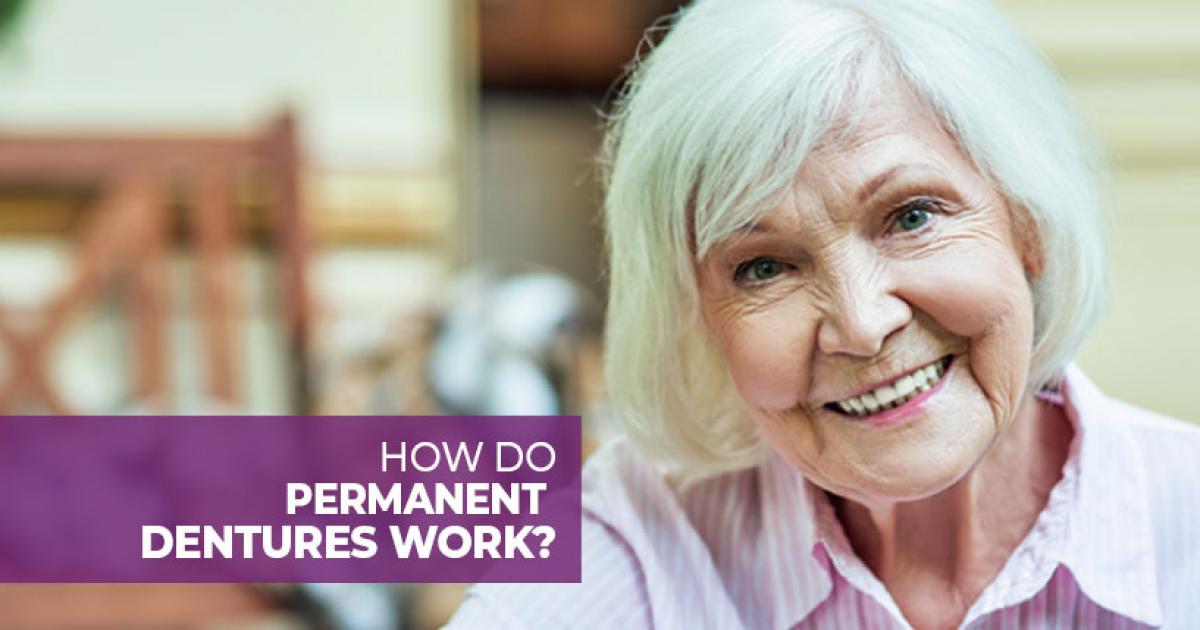 Permanent Dentures How Do They Work?