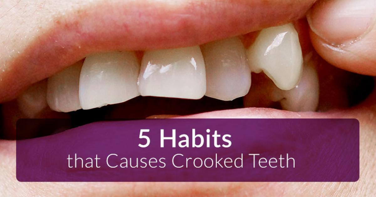 5 Habits That Cause Crooked TeethChange your smile forever
